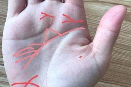 揭秘损姑痣：为何会影响你的婚姻和财运？