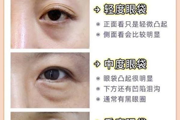 眼袋暴露运势?揭秘女子面相中的眼袋秘密 眼袋暴露运势?揭秘女子面相中的眼袋秘密