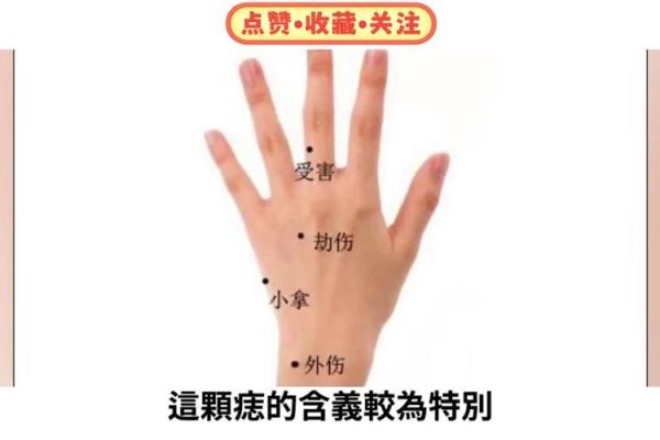 肩头有痣,运势非凡,看看你是否有这样的福痣 肩头有痣,运势非凡,看看你是否有这样的福痣