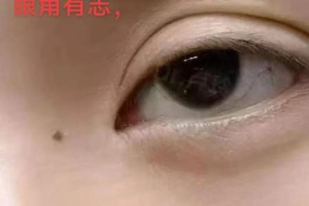 眼角一痣,风情万种