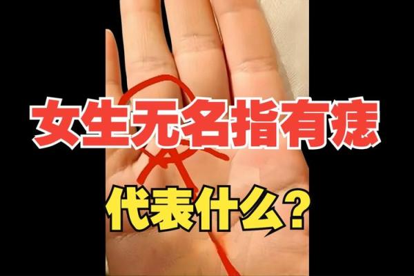 手指上的秘密诱惑:痣的神秘力量 手指上的秘密诱惑:痣的神秘力量