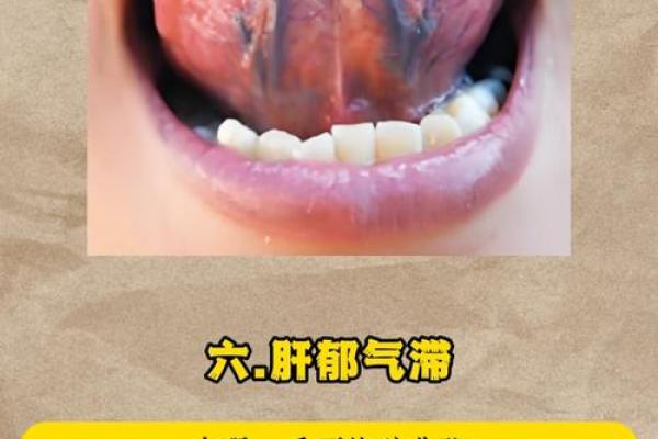 独家解析:口舌痣相背后的秘密,你绝对想不到 独家解析:口舌痣相背后的秘密,你绝对想不到