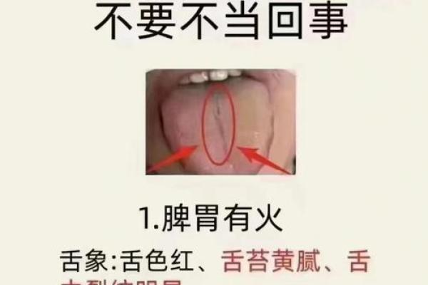 独家解析:口舌痣相背后的秘密,你绝对想不到 独家解析:口舌痣相背后的秘密,你绝对想不到
