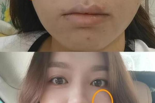 揭秘美人坑面相:如何一眼识破魅力与命运的秘密 揭秘美人坑面相:如何一眼识破魅力与命运的秘密