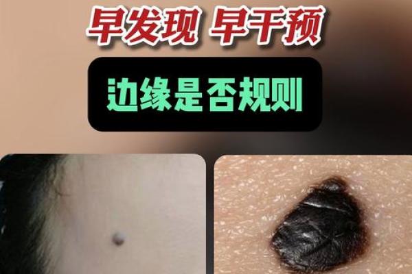 神秘痣色变化，竟是健康预警？