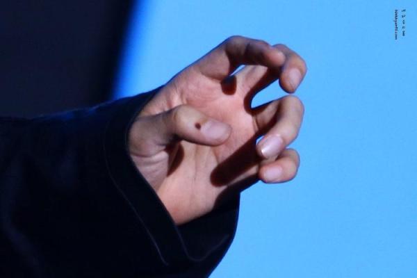 痣相大揭秘：右手小拇指痣暗示的惊人真相