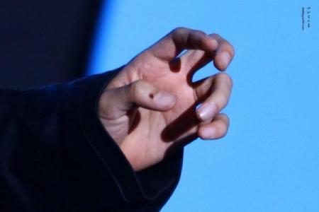 痣相大揭秘：右手小拇指痣暗示的惊人真相