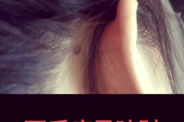 一痣定终身？耳朵痣相揭秘，看看你的痣预示了什么未来