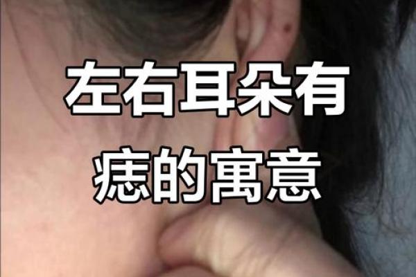 一痣定终身？耳朵痣相揭秘，看看你的痣预示了什么未来