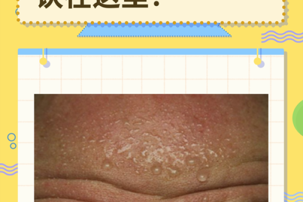 额头皱纹揭示命运：揭秘额头纹路的秘密与人生轨迹