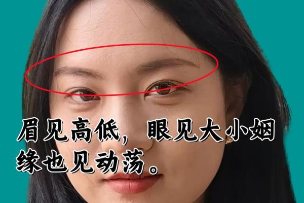 面痣占卜术：女性命运走势一览无余