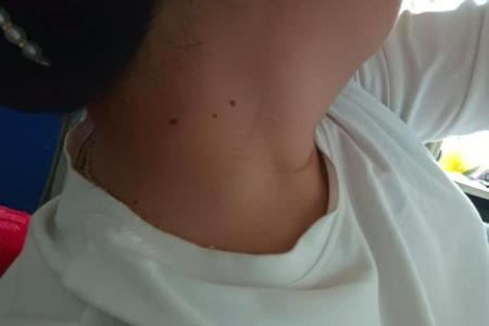 看这里女人背部痣相揭秘