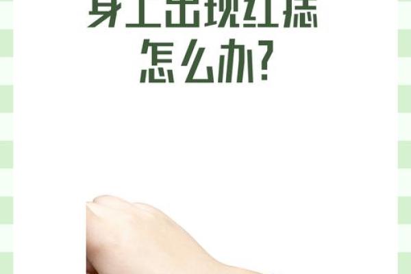 红痣魅力:揭秘男性面部红痣的独特之处 红痣魅力:揭秘男性面部红痣的独特之处