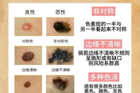 红痣魅力：揭秘男性面部红痣的独特之处